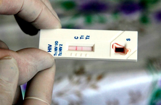 18 de diciembre: Se realizarán Test Rápidos de detección de VIH en SEMO del Edificio Institucional