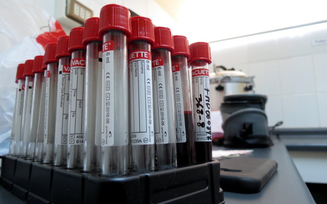 Miércoles 11 de diciembre: Toma de muestras de detección de VIH en campus Valparaíso